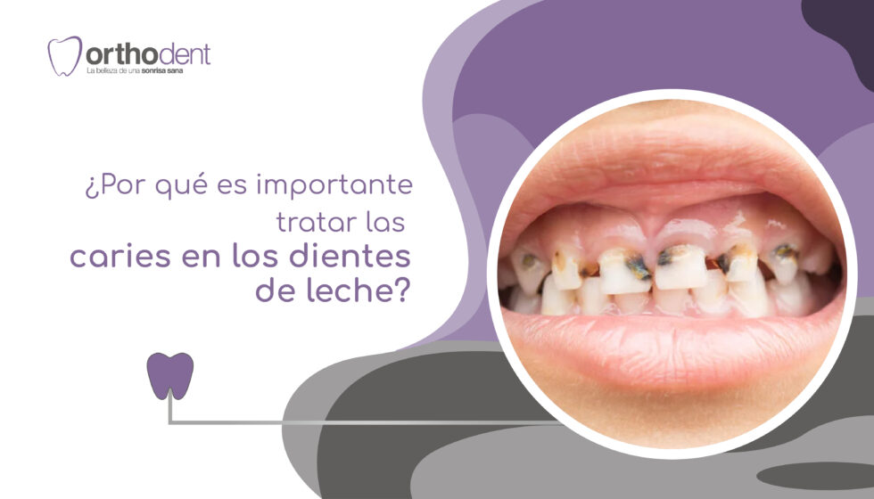 Por qué es importante tratar las caries en los dientes de leche