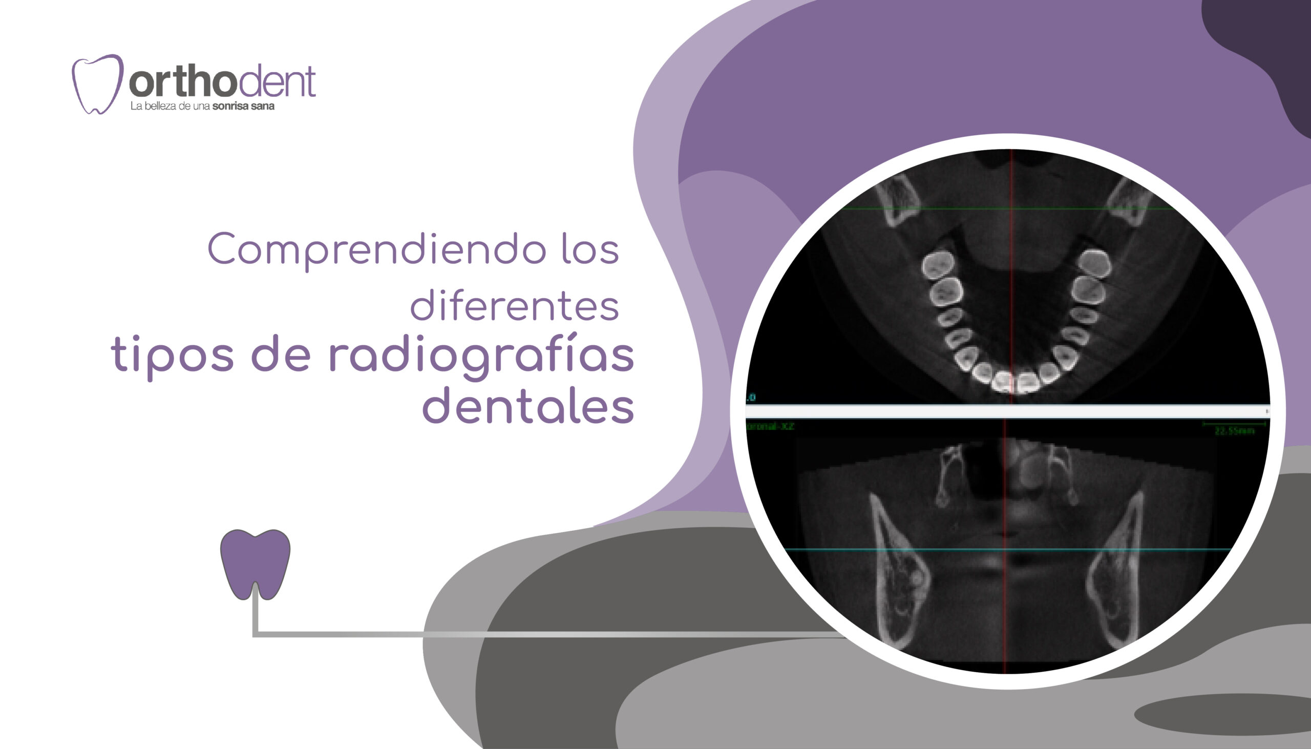 Tipos de radiografías dentales Orthodent