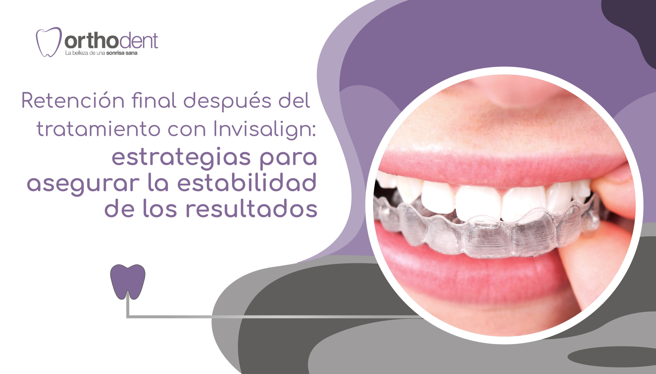 Retenci N Final Despu S Del Tratamiento Con Invisalign Estrategias