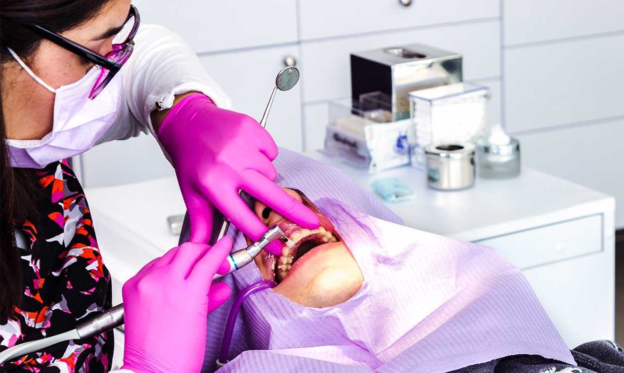 Aclaramiento-Dental-con-Orthodent-Queretaro