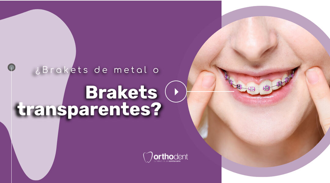 ¿Brakets de metal o Brakets transparentes?