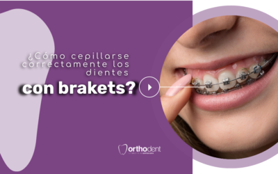 ¿Cómo cepillarse correctamente los dientes con brackets?