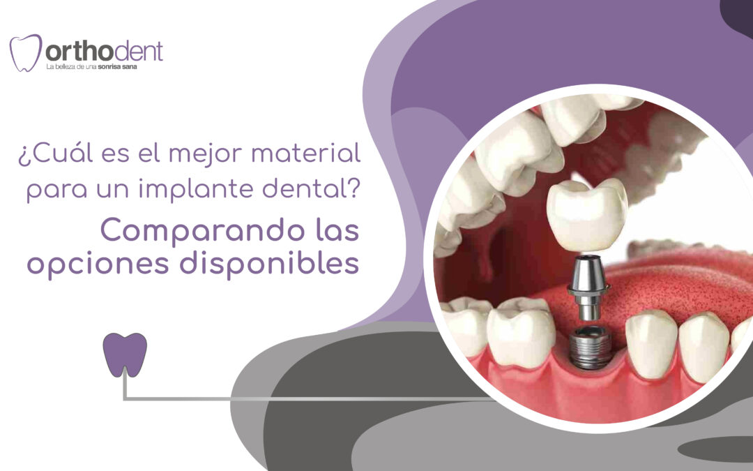 ¿Cuál es el mejor material para un implante dental? Comparando las opciones disponibles