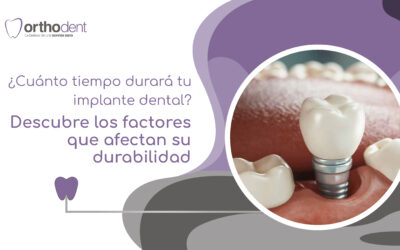 ¿Cuánto tiempo durará tu implante dental? Descubre los factores que afectan su durabilidad