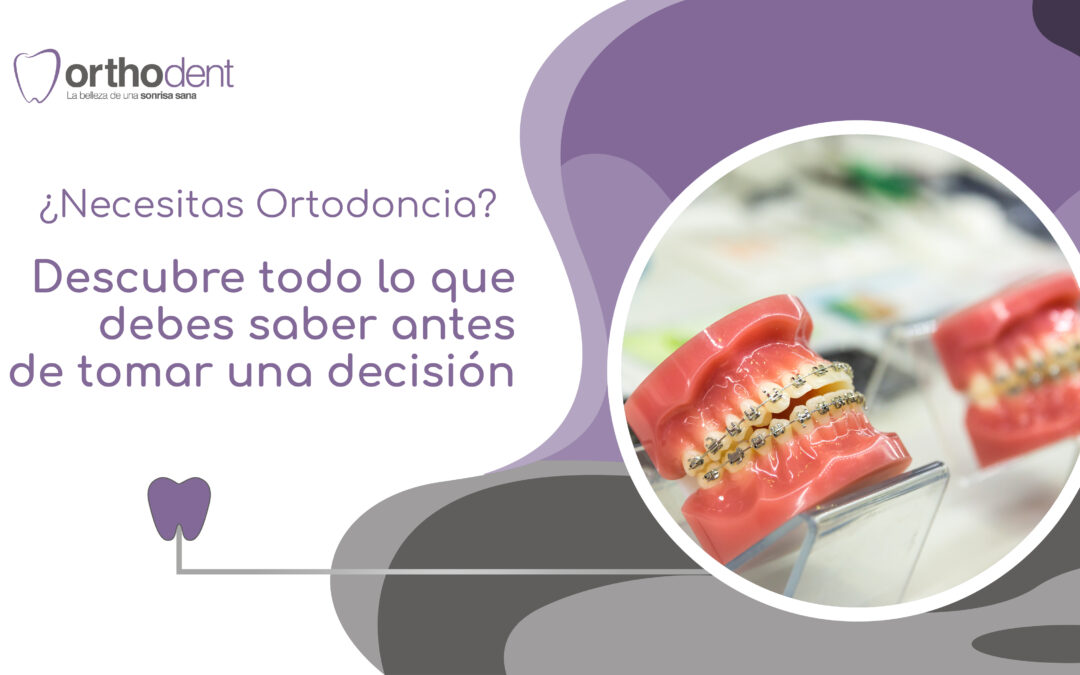 ¿Necesitas Ortodoncia? Descubre todo lo que debes saber antes de tomar una decisión