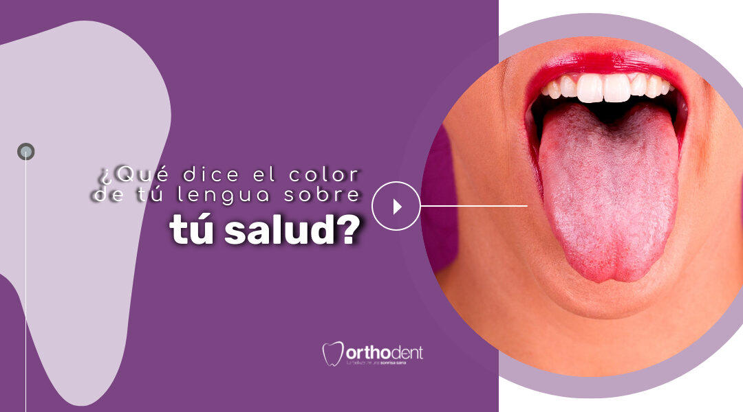¿Qué dice el color de tú lengua sobre tú salud?