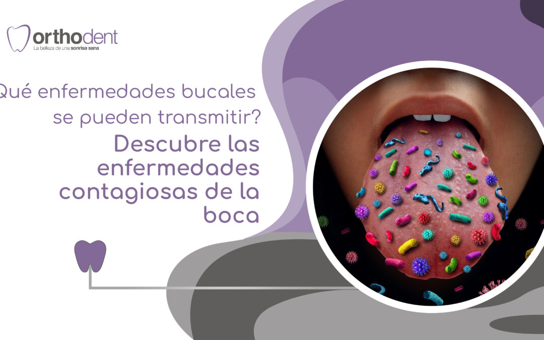 Que enfermedades bucales se pueden transmitir Descubre las enfermedades contagiosas de la boca