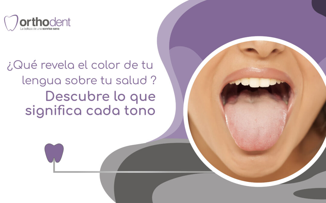 ¿Qué revela el color de tu lengua sobre tu salud? Descubre lo que significa cada tono