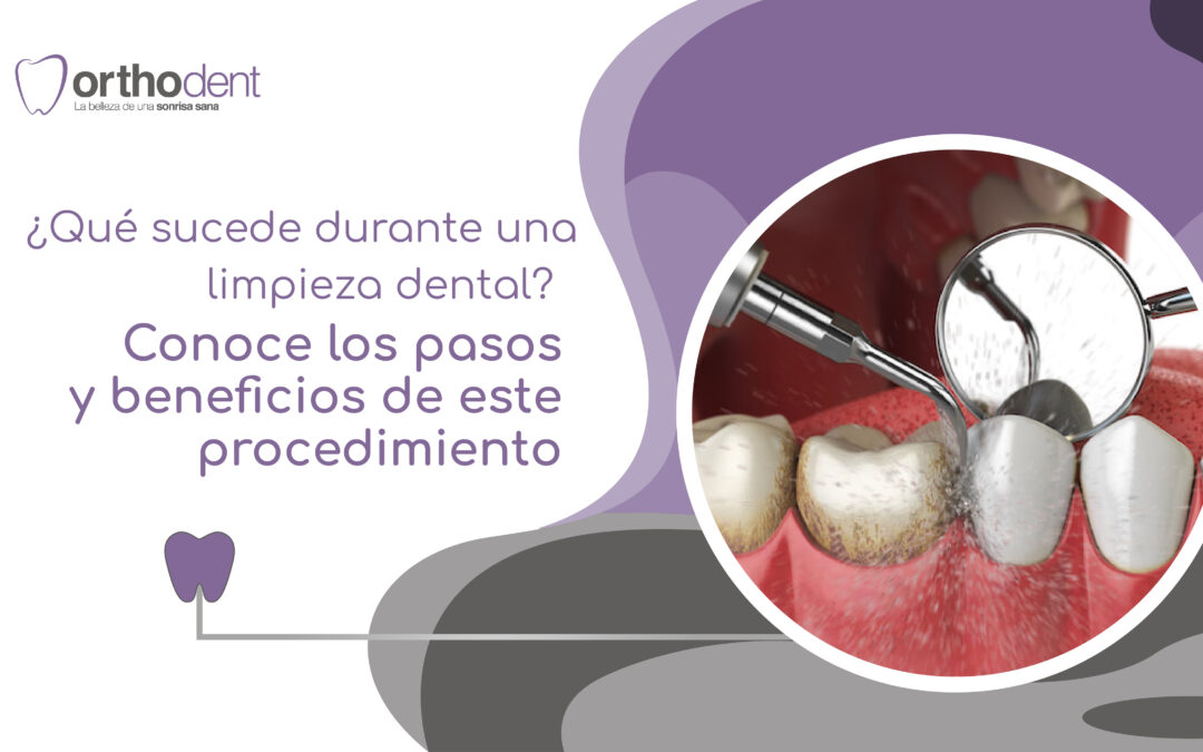¿Qué sucede durante una limpieza dental? Conoce los pasos y beneficios de este procedimiento
