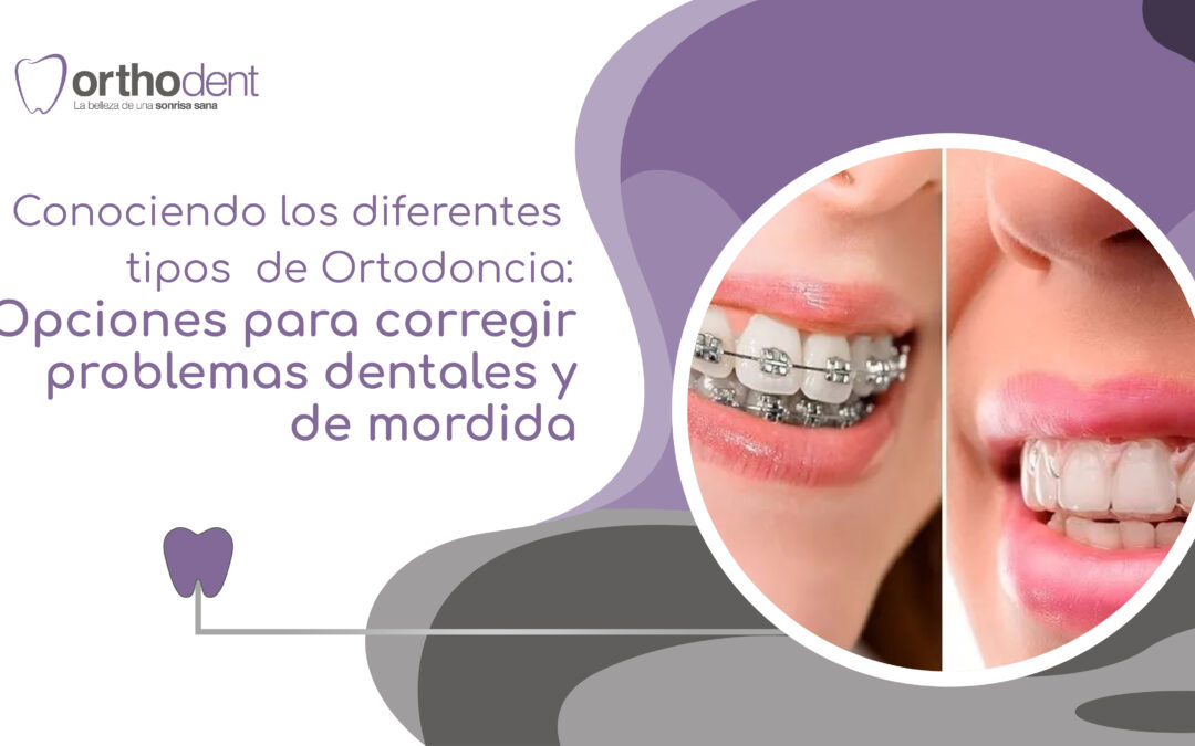 Conociendo los diferentes tipos de ortodoncia: opciones para corregir problemas dentales y de mordida
