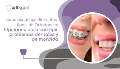 Diferentes Tipos De Ortodoncia - Orthodent