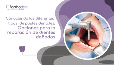 Conociendo los diferentes tipos de postes dentales: opciones para la ...