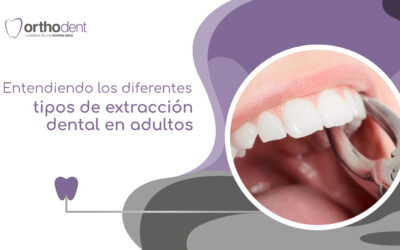 Entendiendo los diferentes tipos de extracción dental en adultos