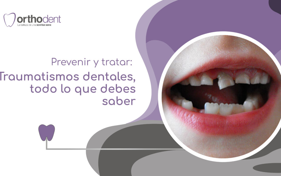 Prevenir y tratar Traumatismos dentales todo lo que debes saber