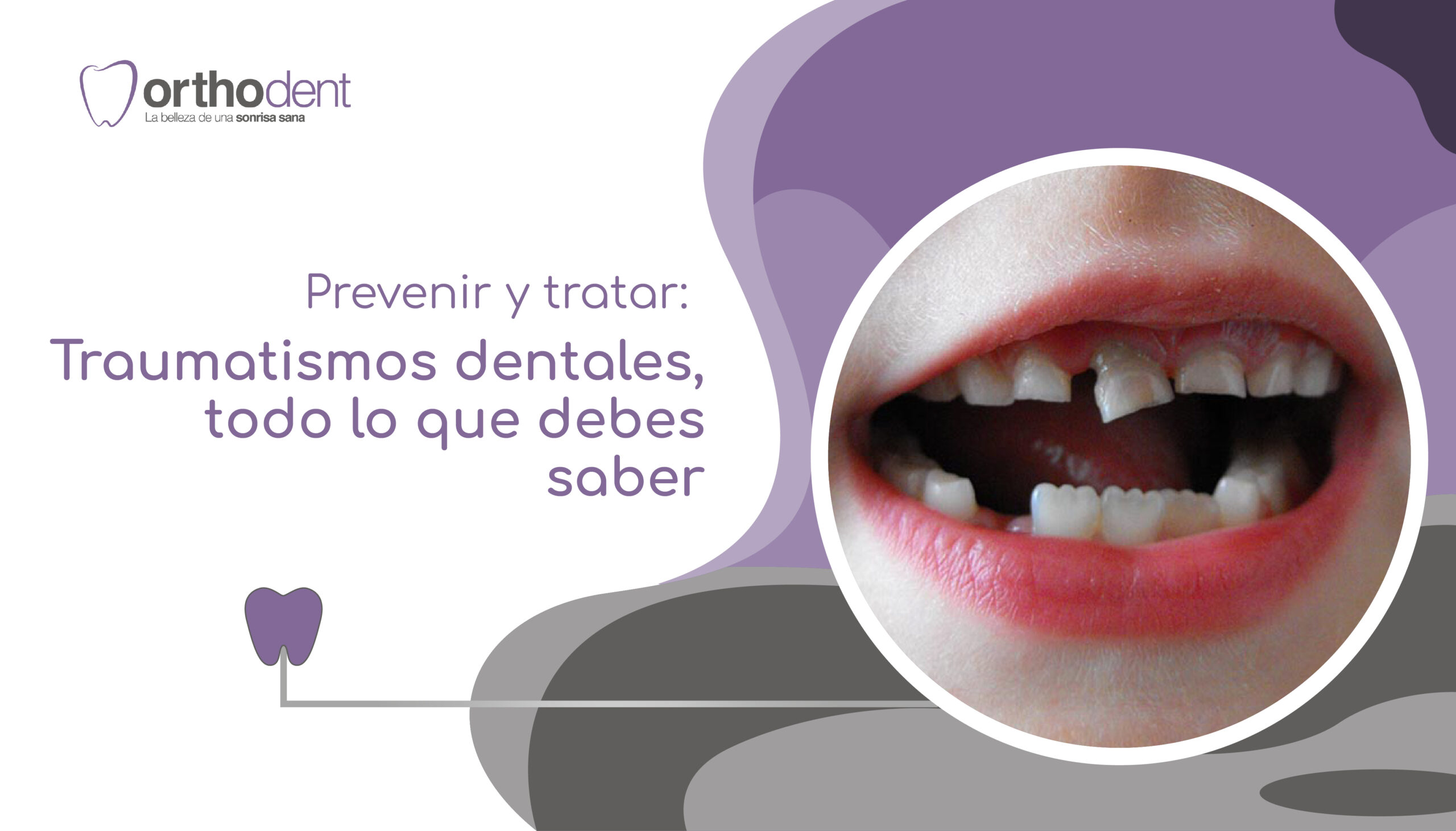 Prevenir Y Tratar: Traumatismos Dentales, Todo Lo Que Debes Saber ...