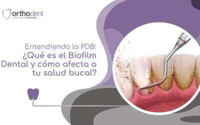 Entendiendo la PDB: ¿Qué es el Biofilm Dental y cómo afecta a tu salud bucal?