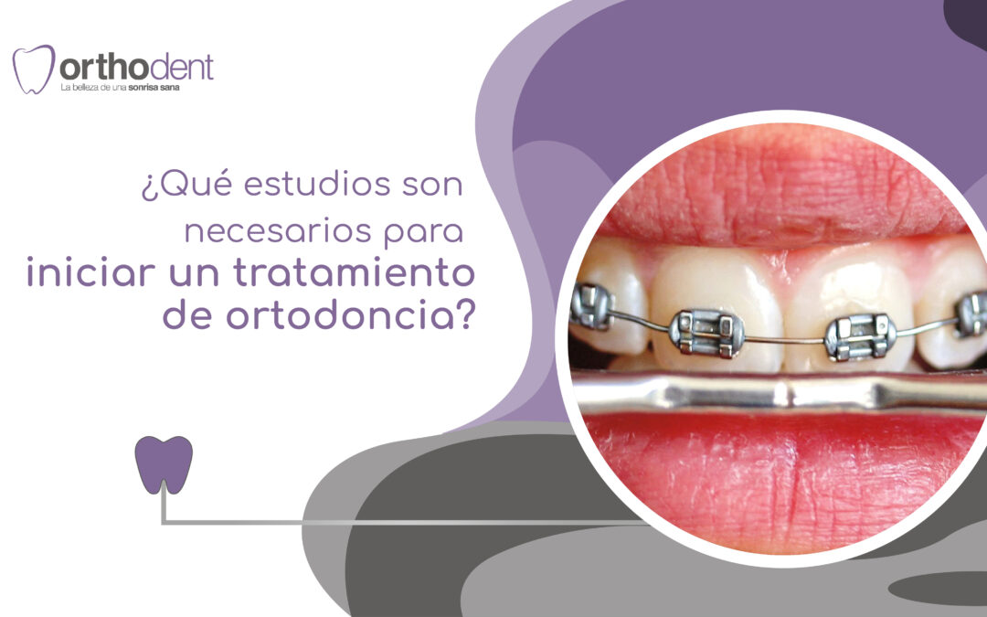 ¿Qué estudios son necesarios para iniciar un tratamiento de ortodoncia?